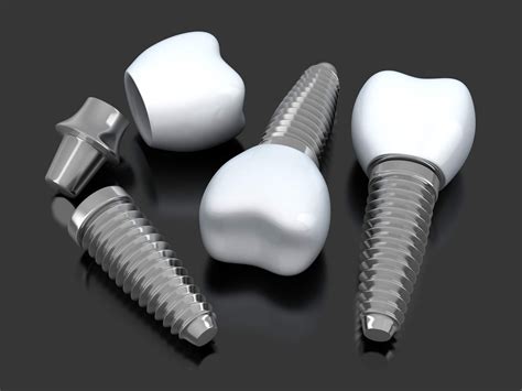 dental school low cost implants